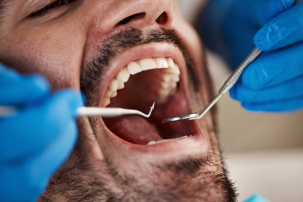 Best Emergency Broken Tooth Repair in Elma, WA